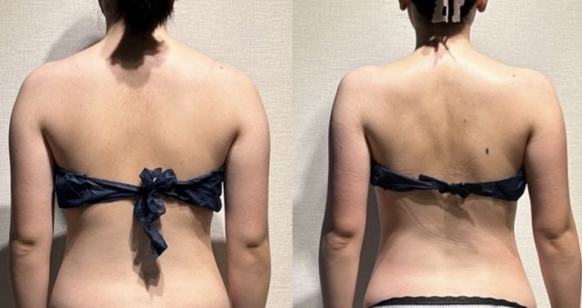 キャコさんのエステの写真