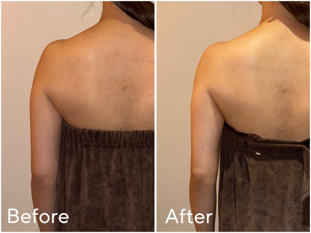 かさんのエステの写真